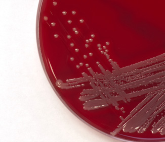 petri dish